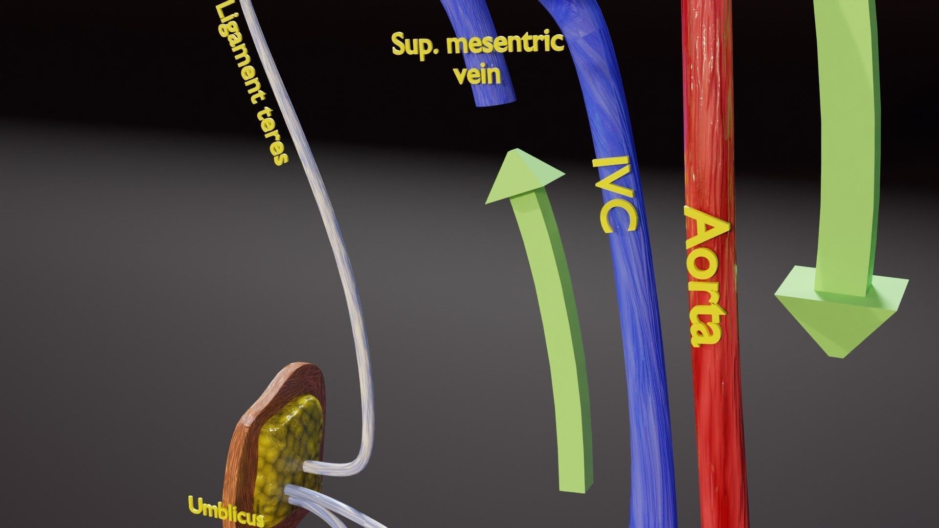 TAF Tetralogy of Fallot vs Normal circulation Low-poly 3D model_28