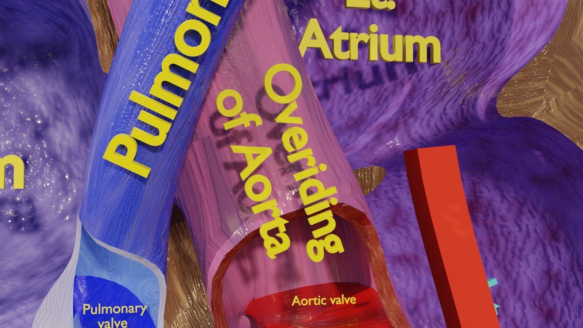 TAF Tetralogy of Fallot vs Normal circulation Low-poly 3D model_13