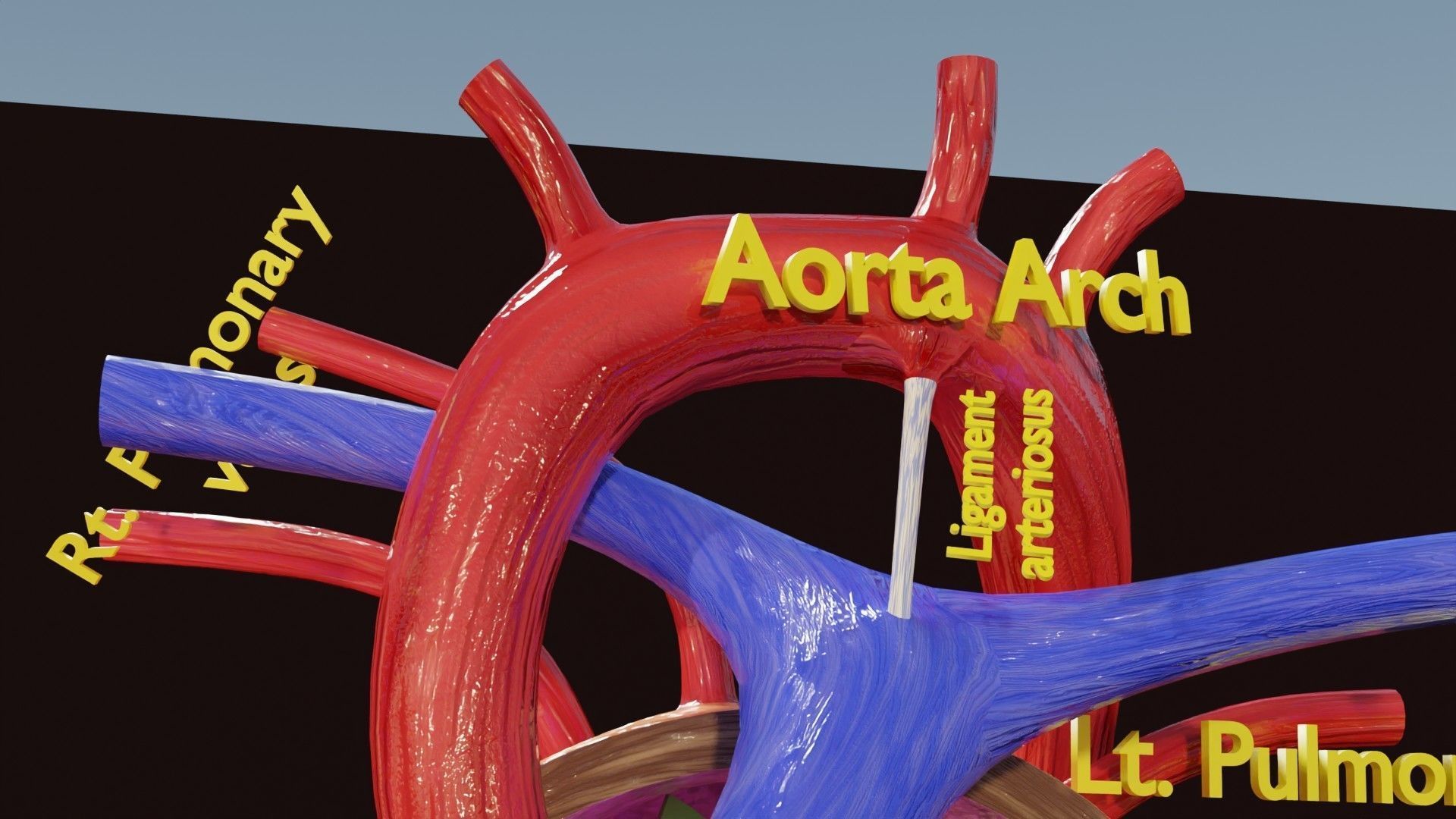 TAF Tetralogy of Fallot vs Normal circulation Low-poly 3D model_33