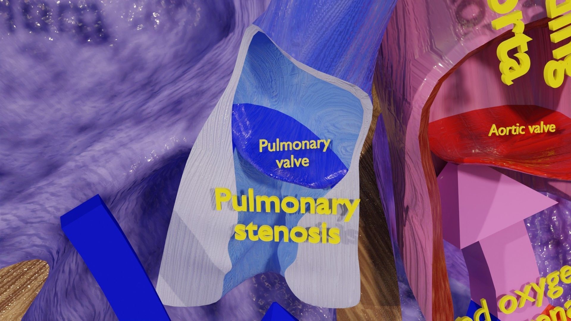 TAF Tetralogy of Fallot vs Normal circulation Low-poly 3D model_19