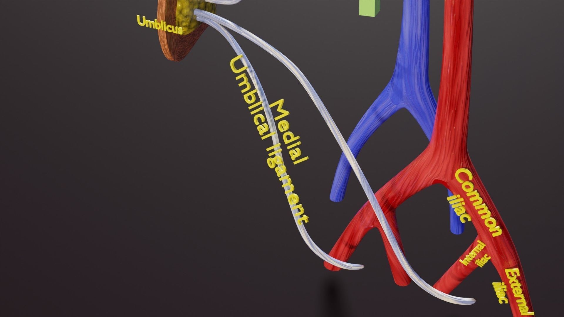 TAF Tetralogy of Fallot vs Normal circulation Low-poly 3D model_27