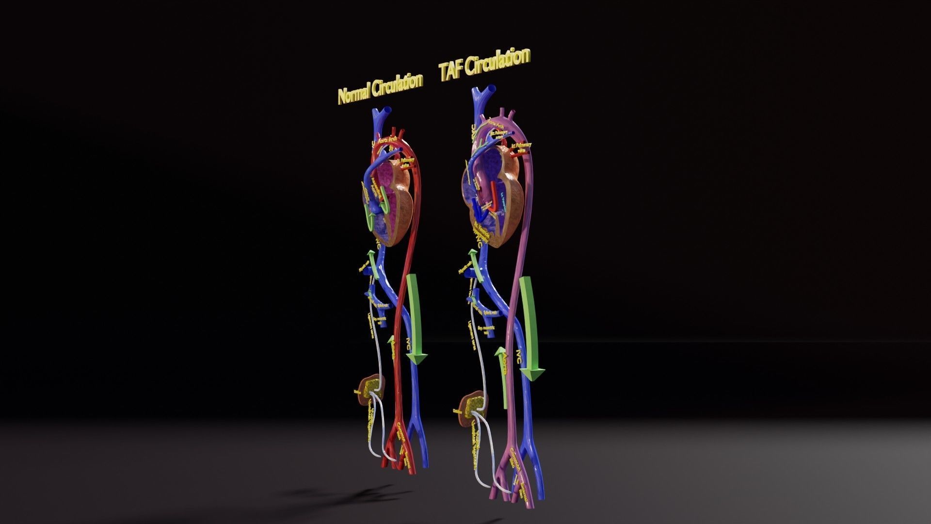 TAF Tetralogy of Fallot vs Normal circulation Low-poly 3D model_5