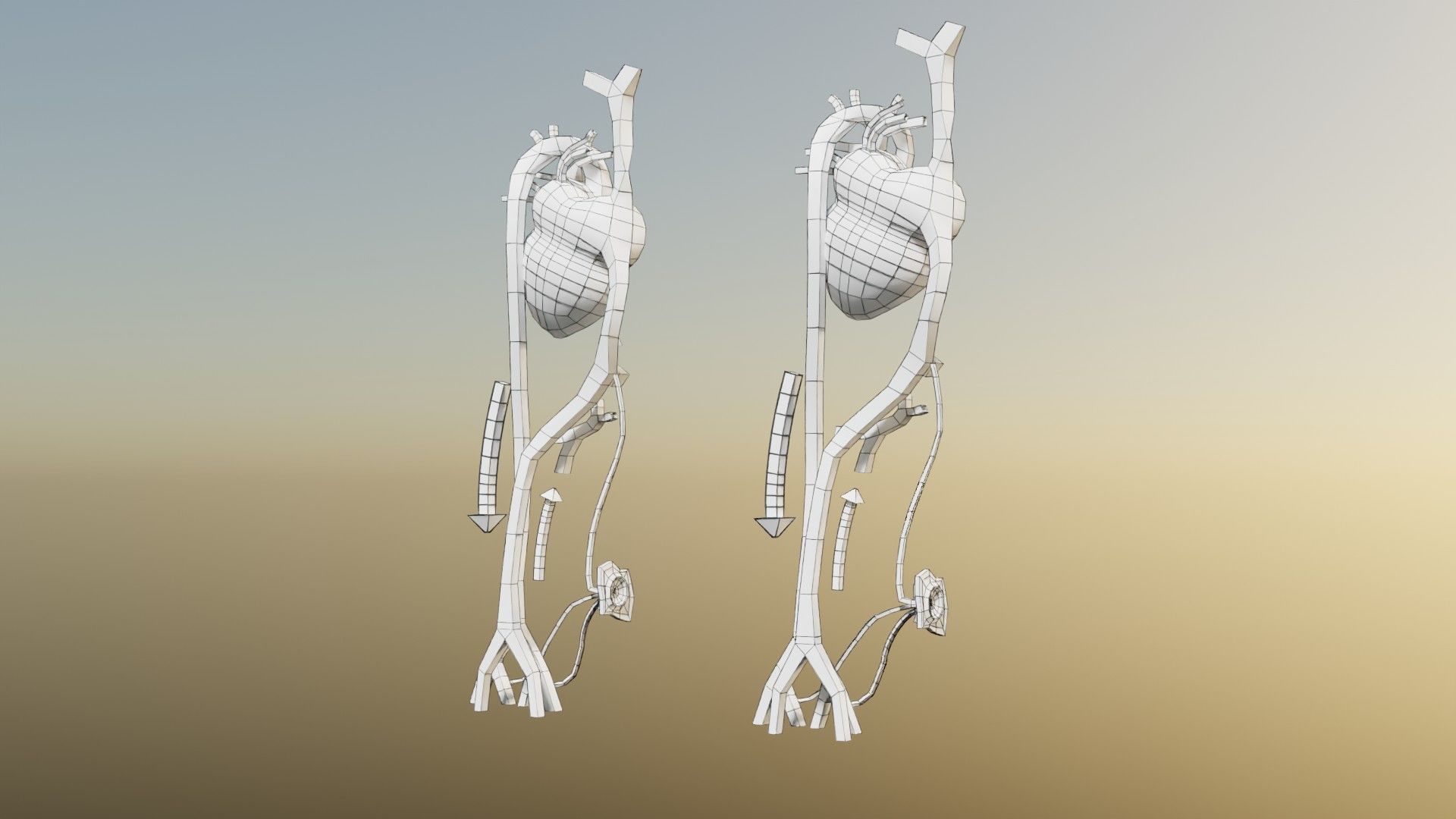 TAF Tetralogy of Fallot vs Normal circulation Low-poly 3D model_62