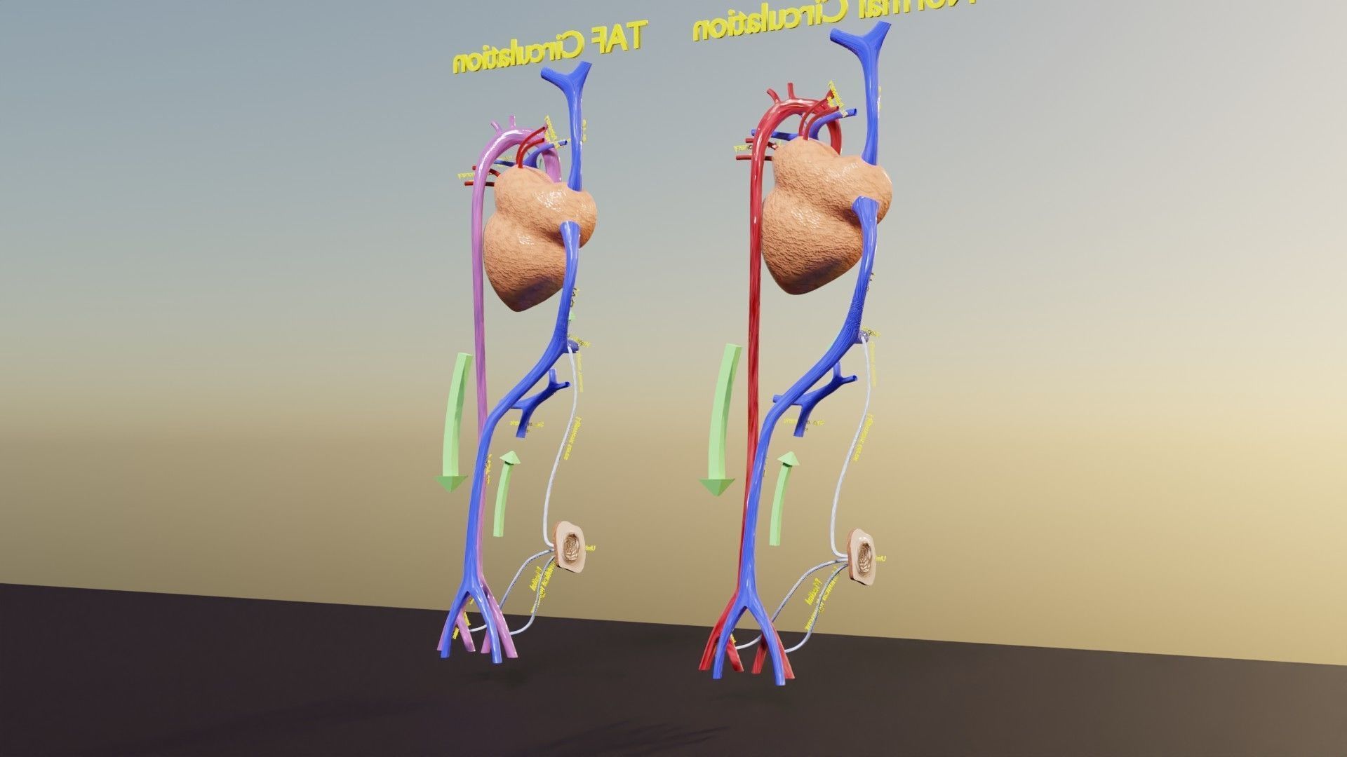 TAF Tetralogy of Fallot vs Normal circulation Low-poly 3D model_40