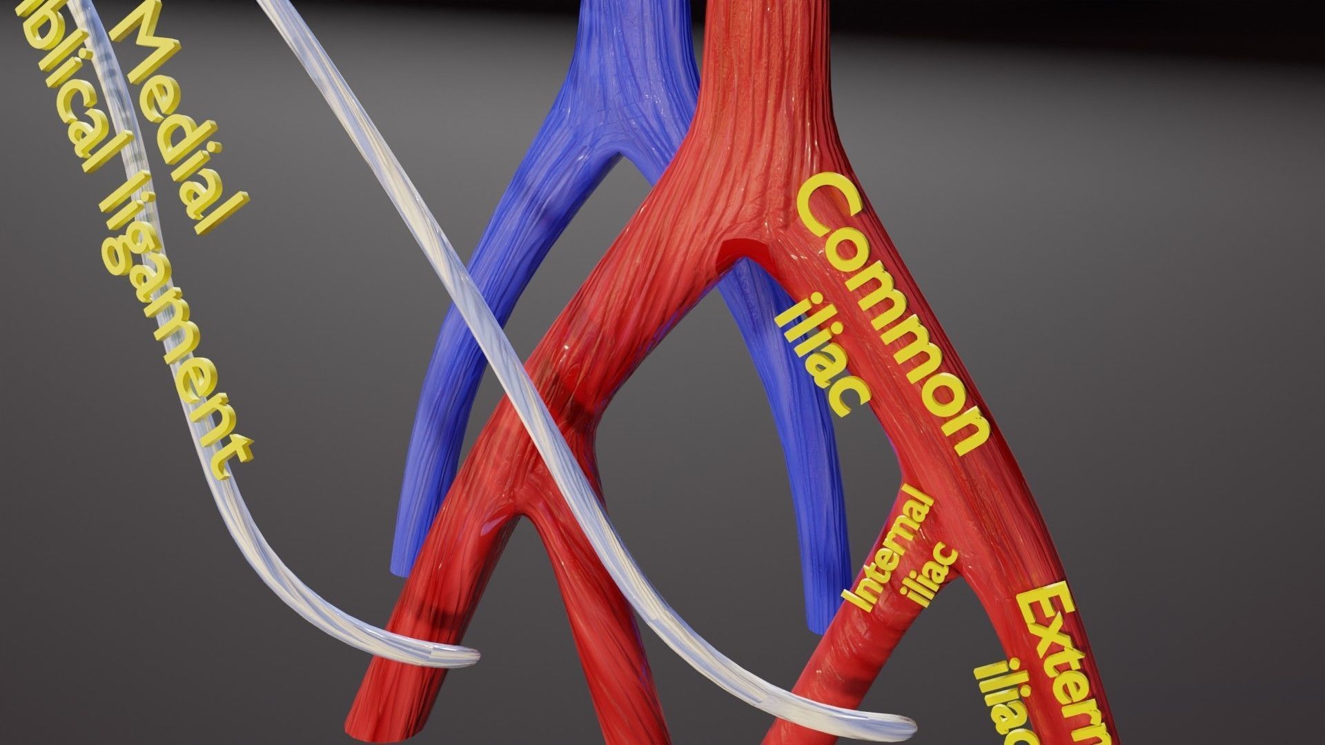 TAF Tetralogy of Fallot vs Normal circulation Low-poly 3D model_34