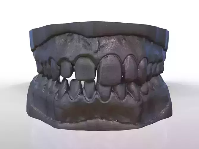 Digital Provisional Prepared Model 3D print model