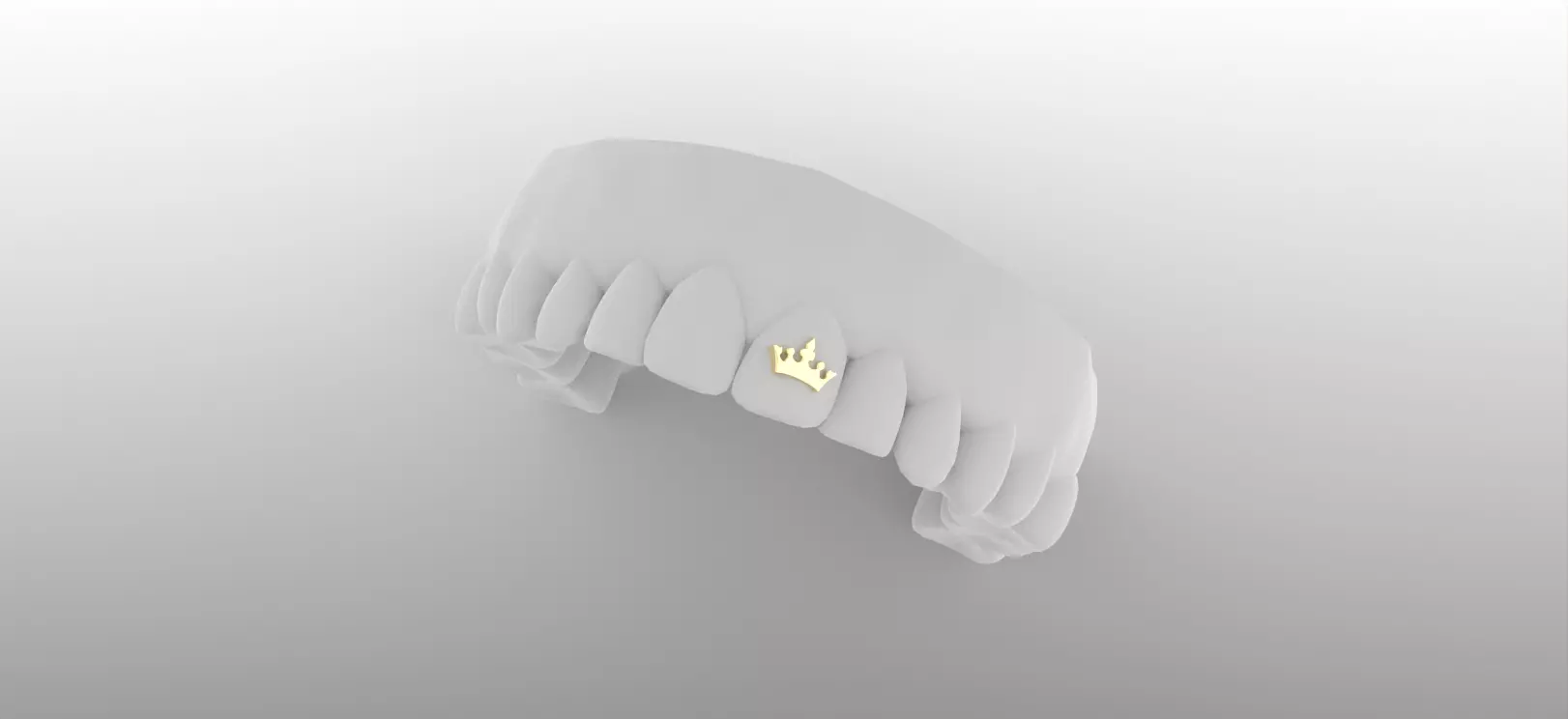 Toothgem Crown Casting Ready 3D print model