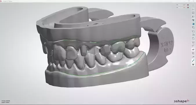Digital Model with Functionality Articulator Interfaces