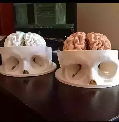 Skull and brain 3D print model