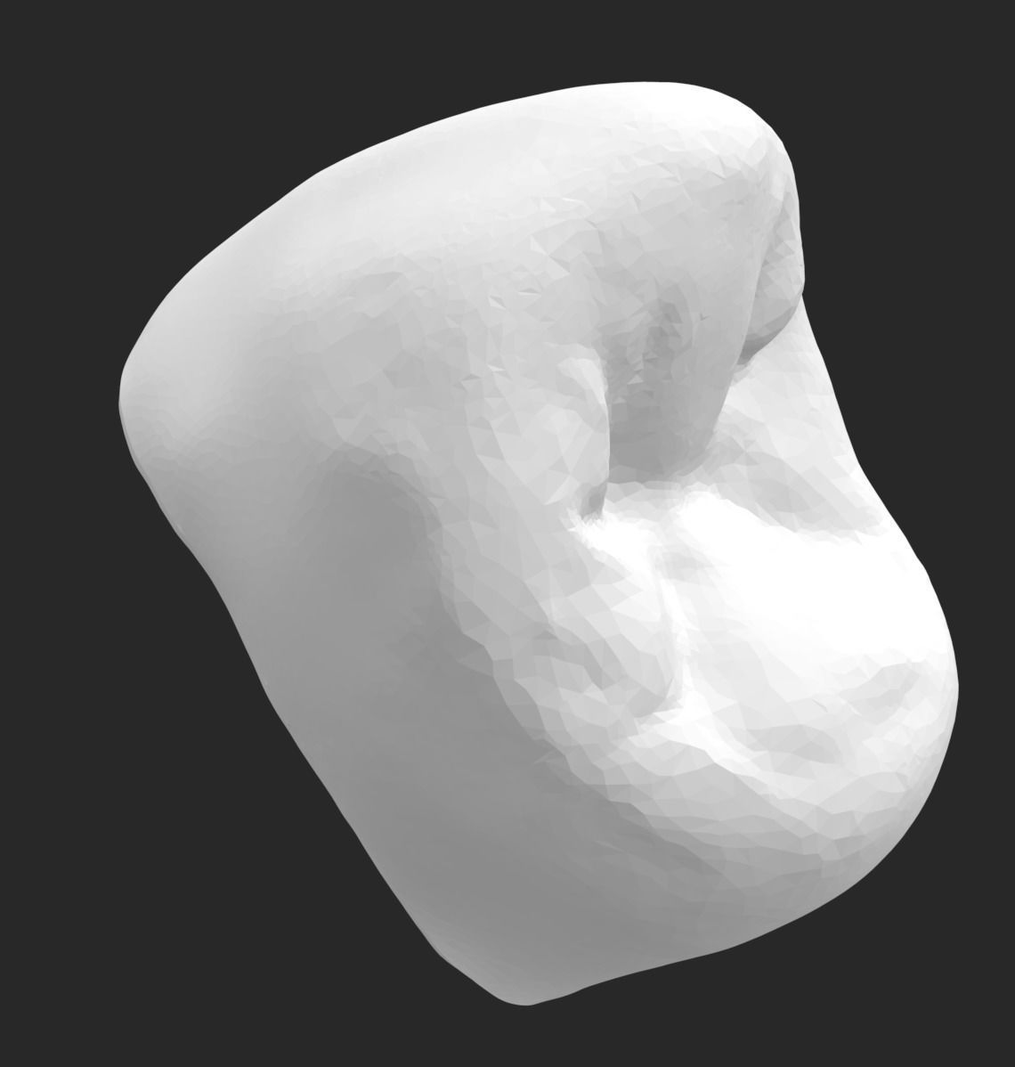 DENTAL MULTIPURPOSE MODEL - ZOCALO DENTAL STRAUMANN NC 3D print model_2