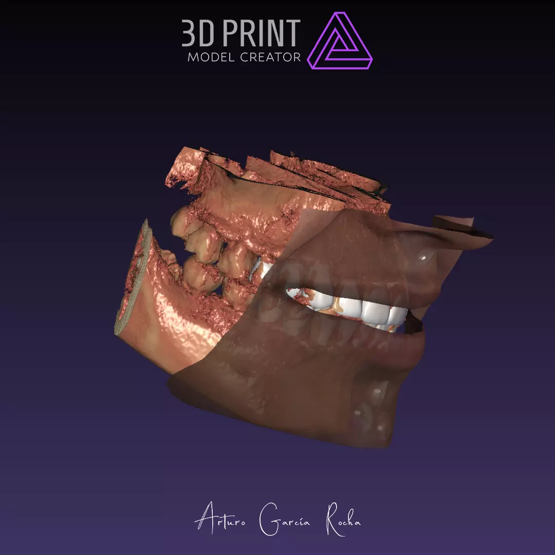 ENCERADO CARILLAS PROFACE CONEBEAM 3D print model