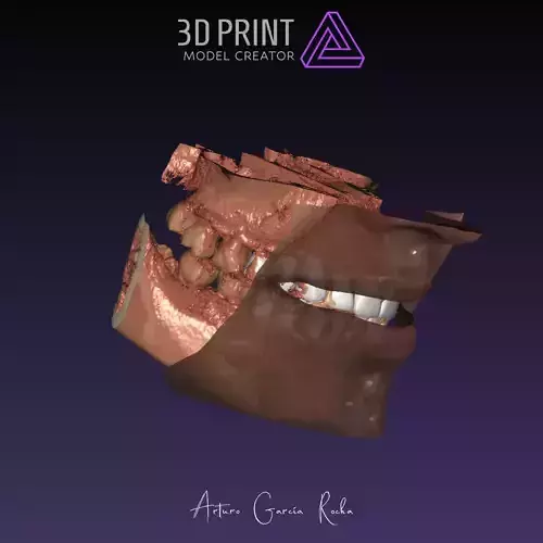 ENCERADO CARILLAS PROFACE CONEBEAM