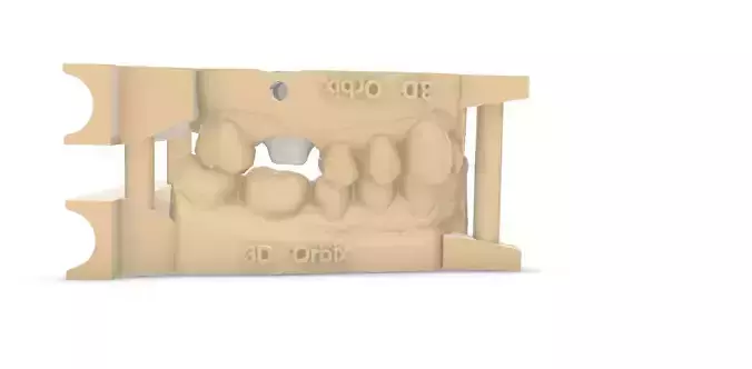 Digital Quadrant Model with Orbix WPins Articulator Interfaces