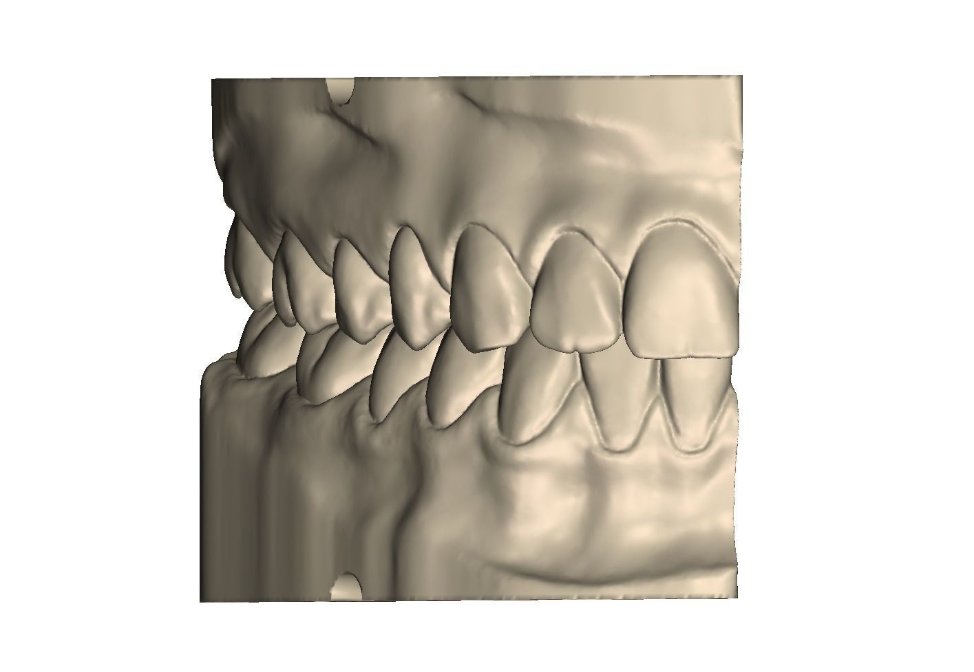 Dental Practice Model Kit 3D print model_2