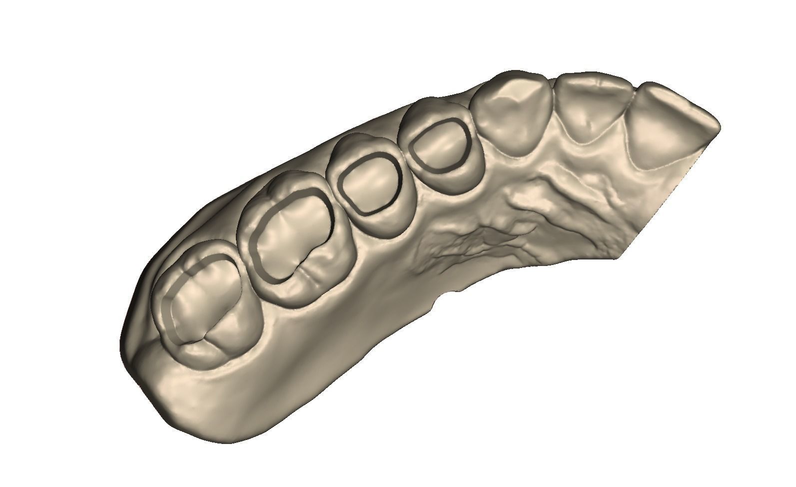 Dental Practice Model Kit 3D print model_10