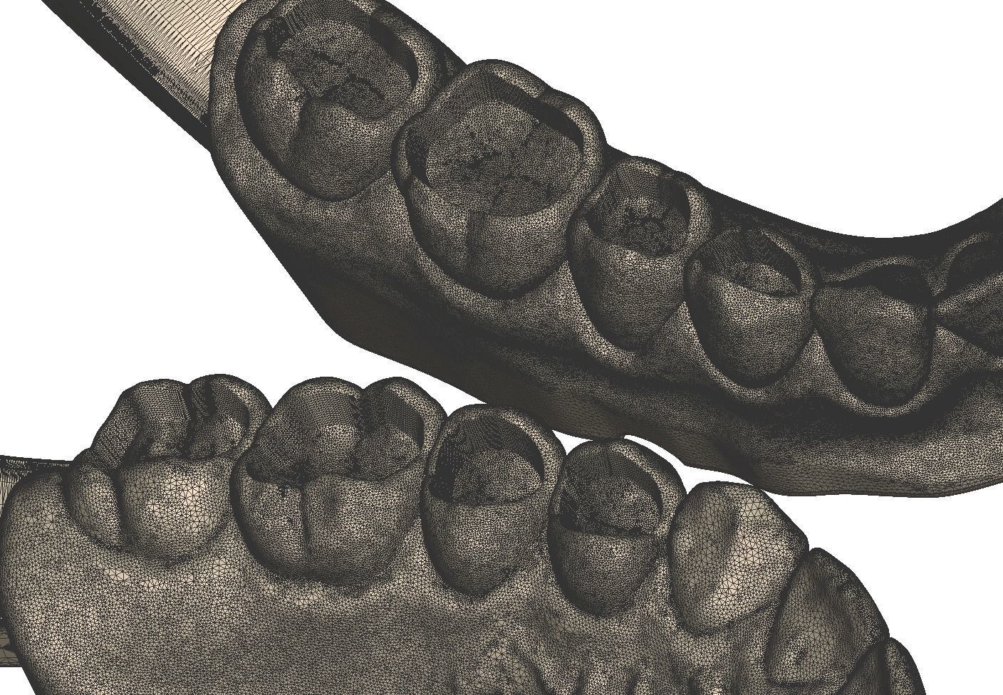 Dental Practice Model Kit 3D print model_19