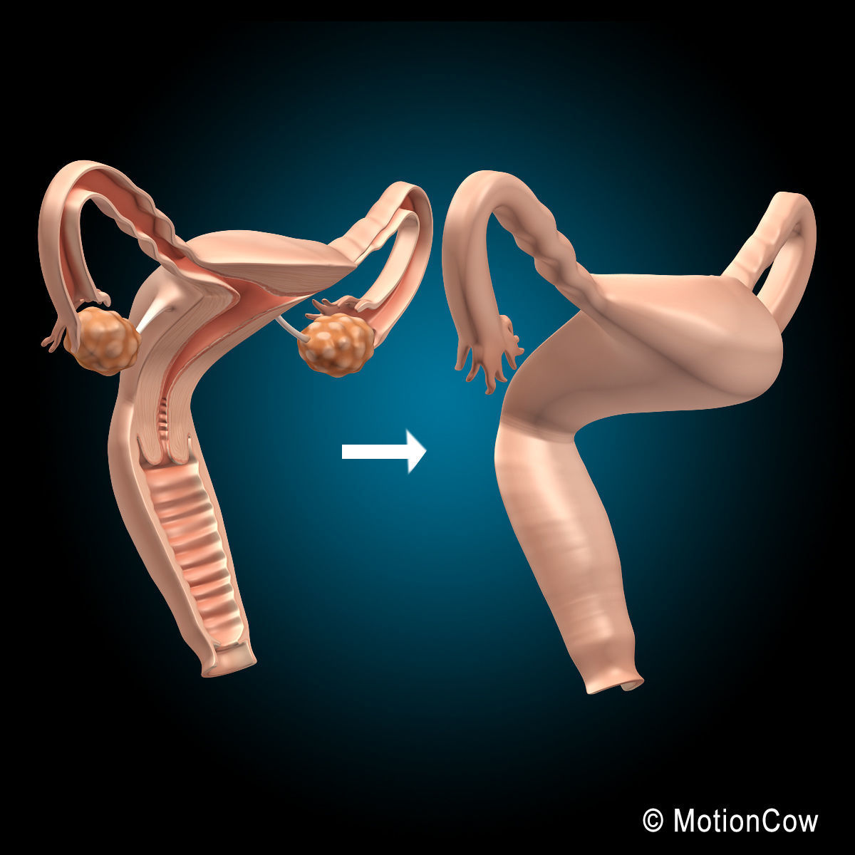 Uterus X-Section 3D model_9