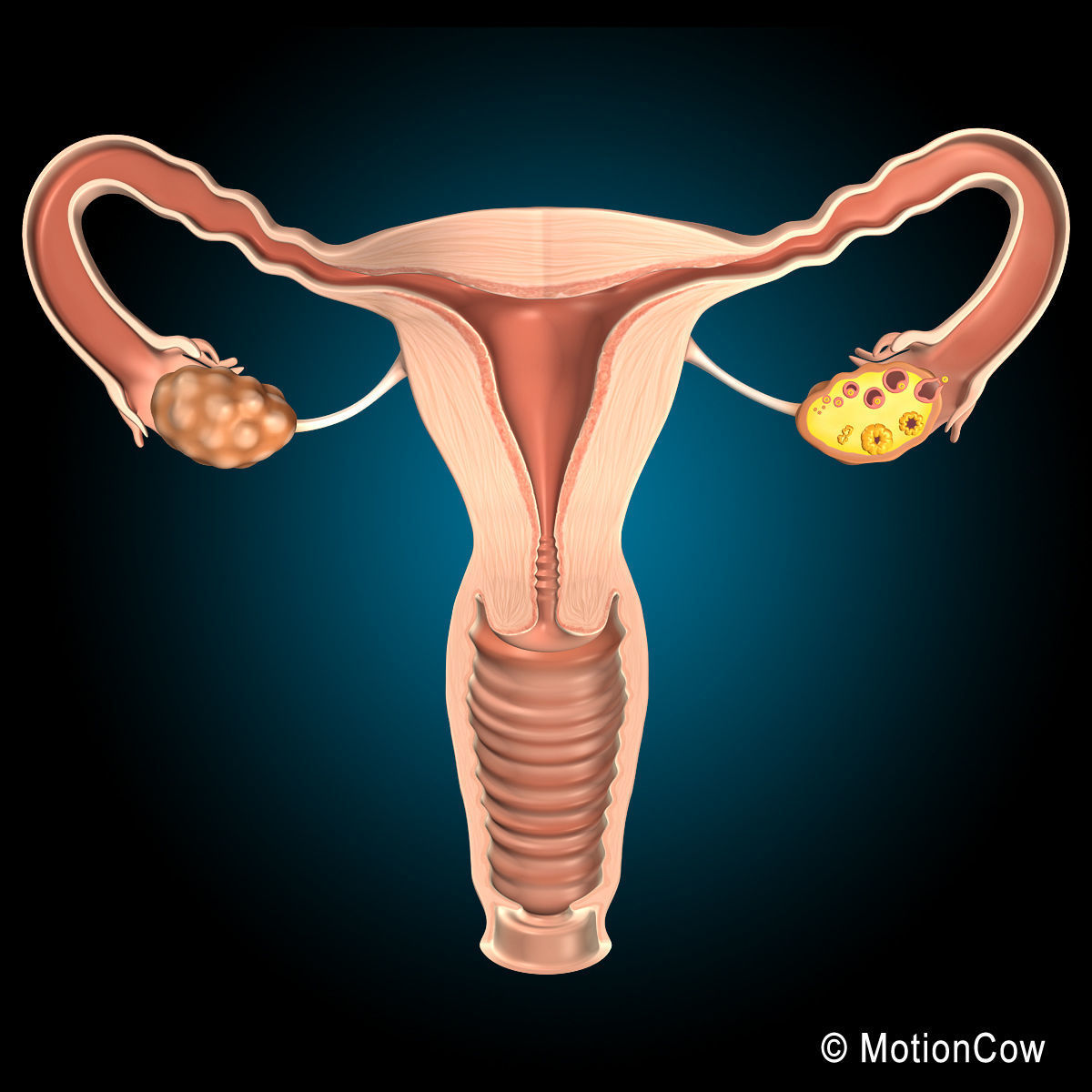 Uterus X-Section 3D model_3