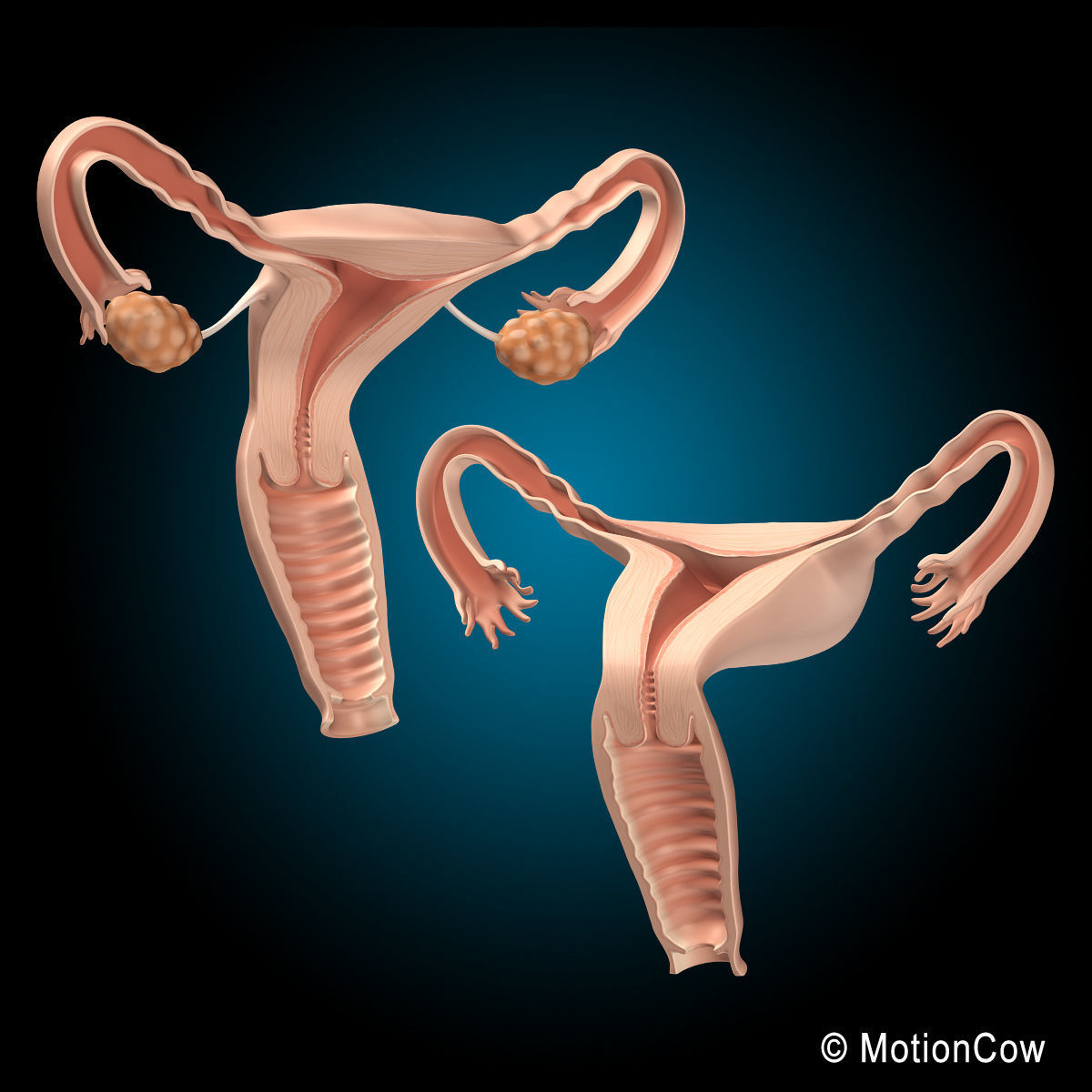 Uterus X-Section 3D model_10