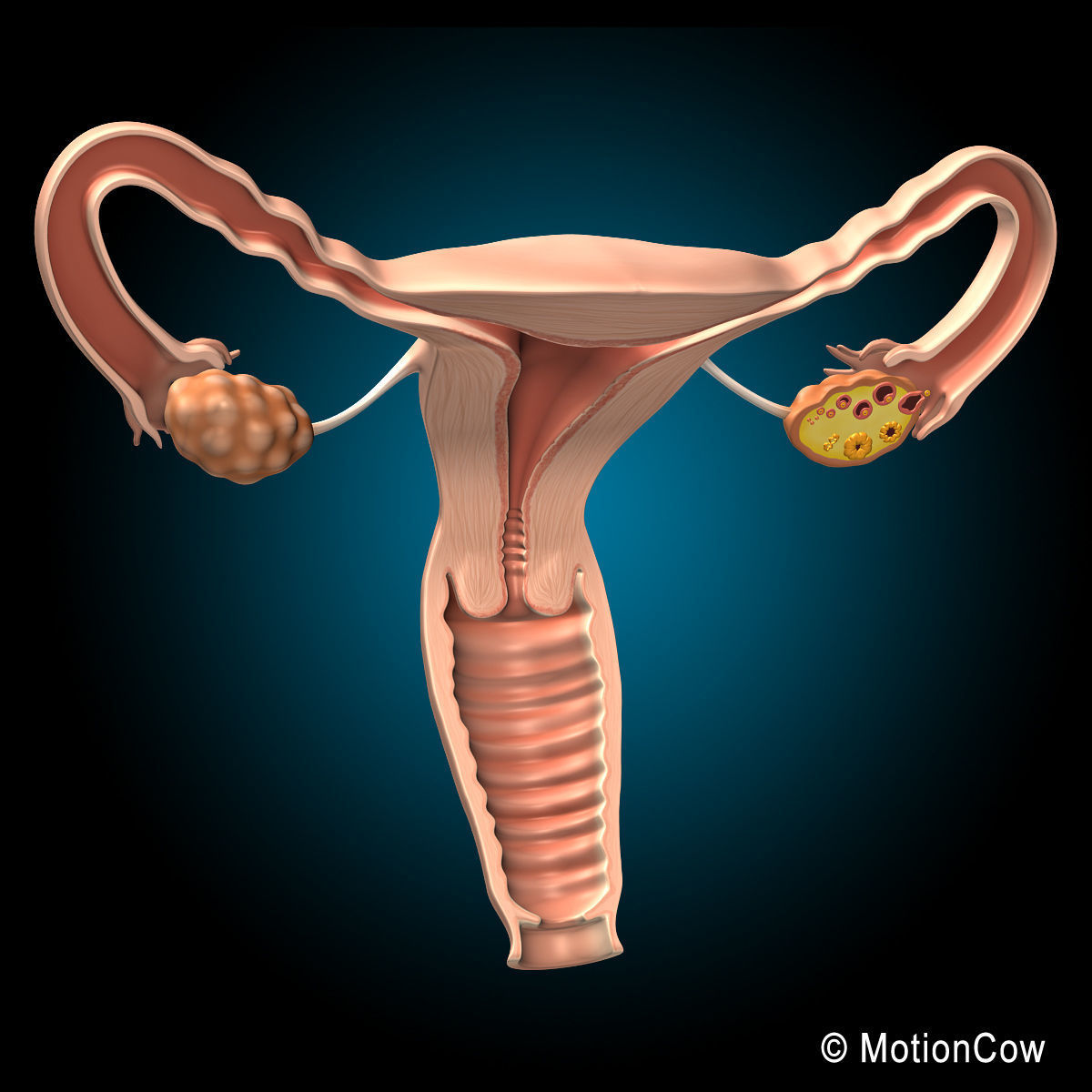 Uterus X-Section 3D model_5