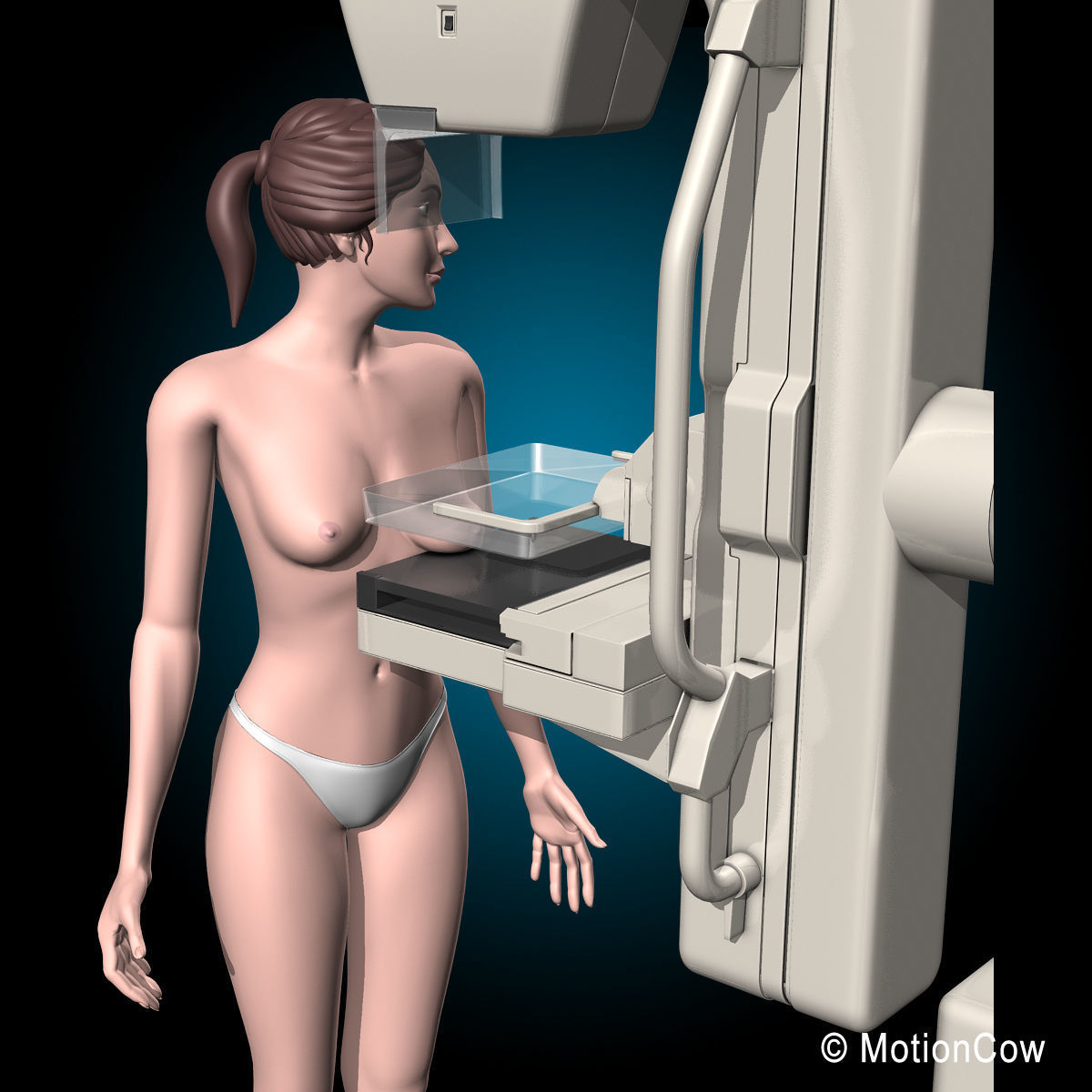 Mammogram 3D model_10