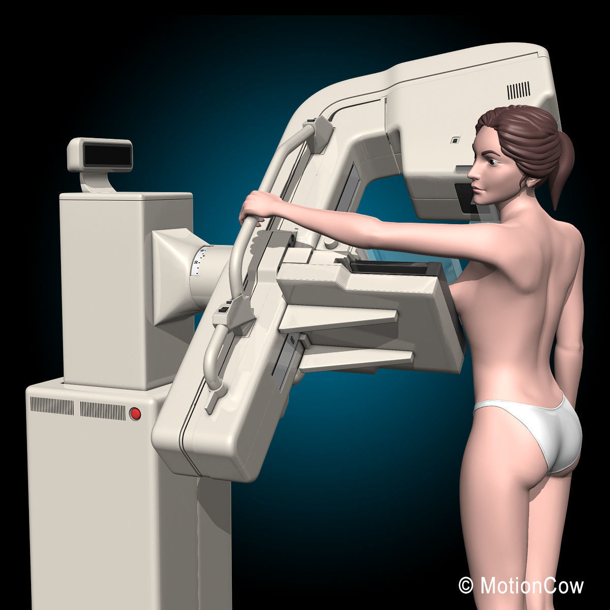 Mammogram 3D model_3