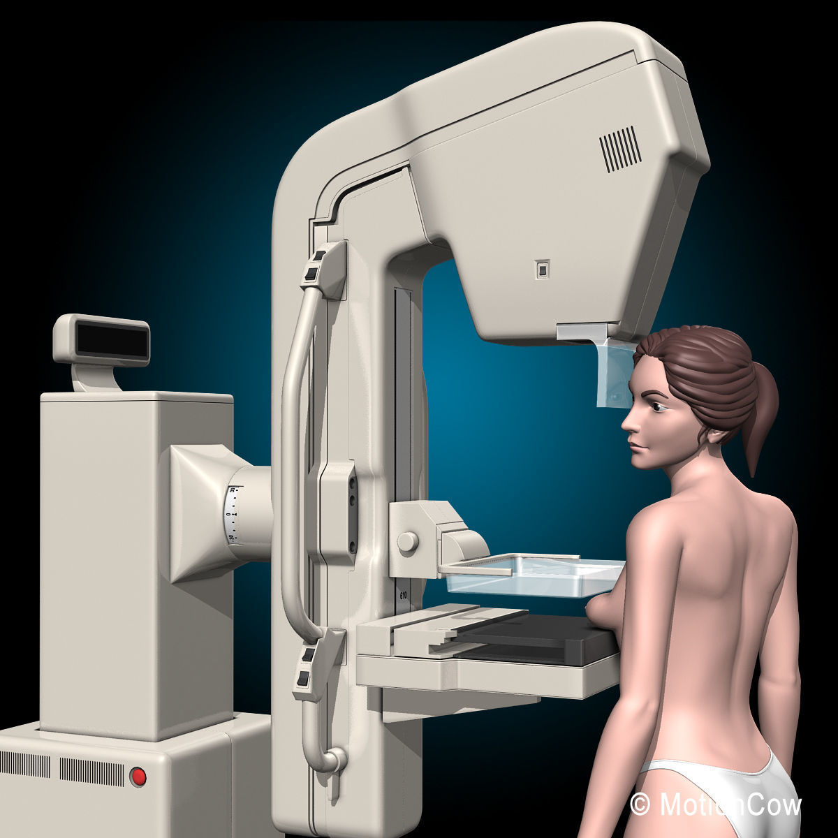 Mammogram 3D model_1