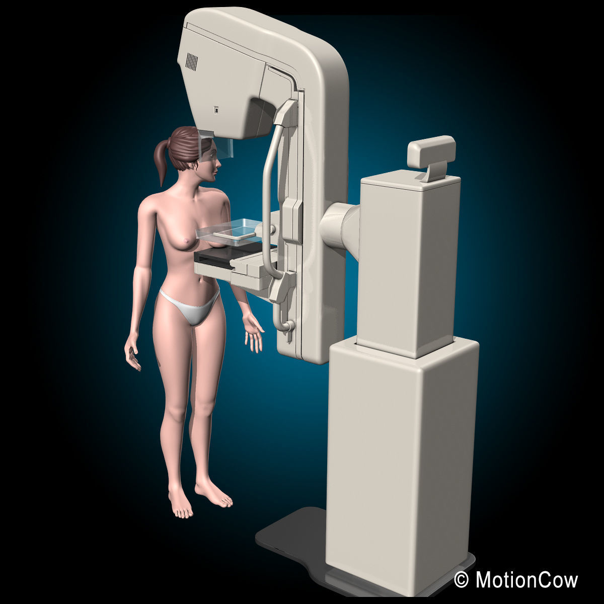 Mammogram 3D model_9