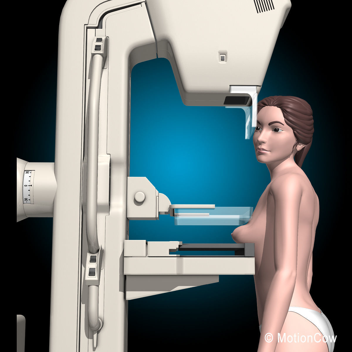 Mammogram 3D model_12