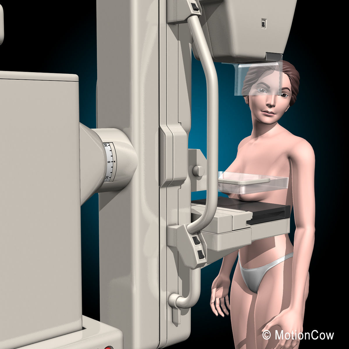 Mammogram 3D model_5