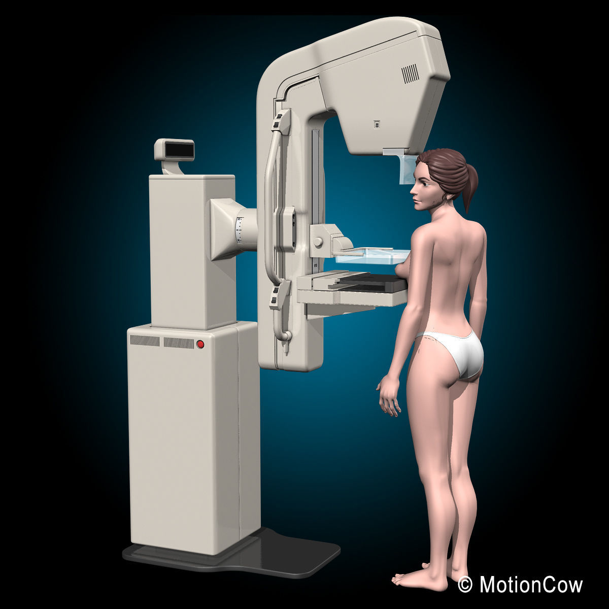Mammogram 3D model_2