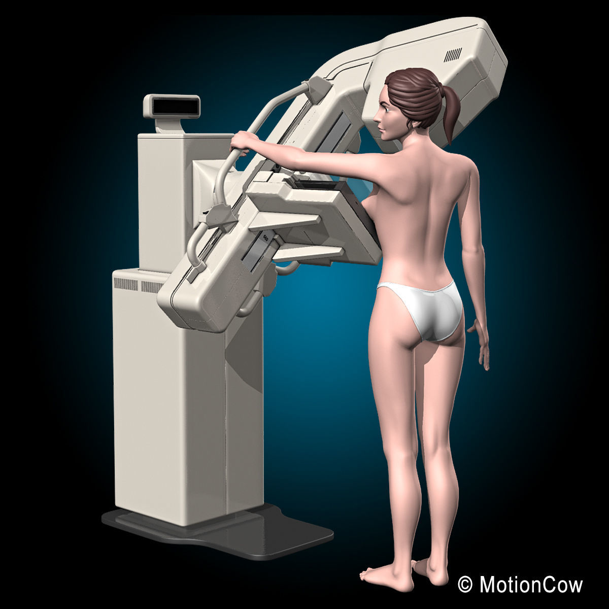 Mammogram 3D model_4