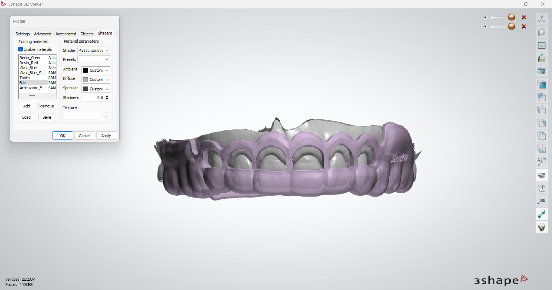 Digital Gingivectomy Guide 3D print model_8