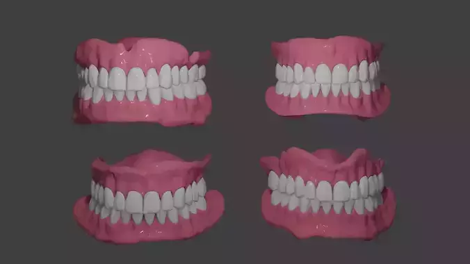 Full denture
