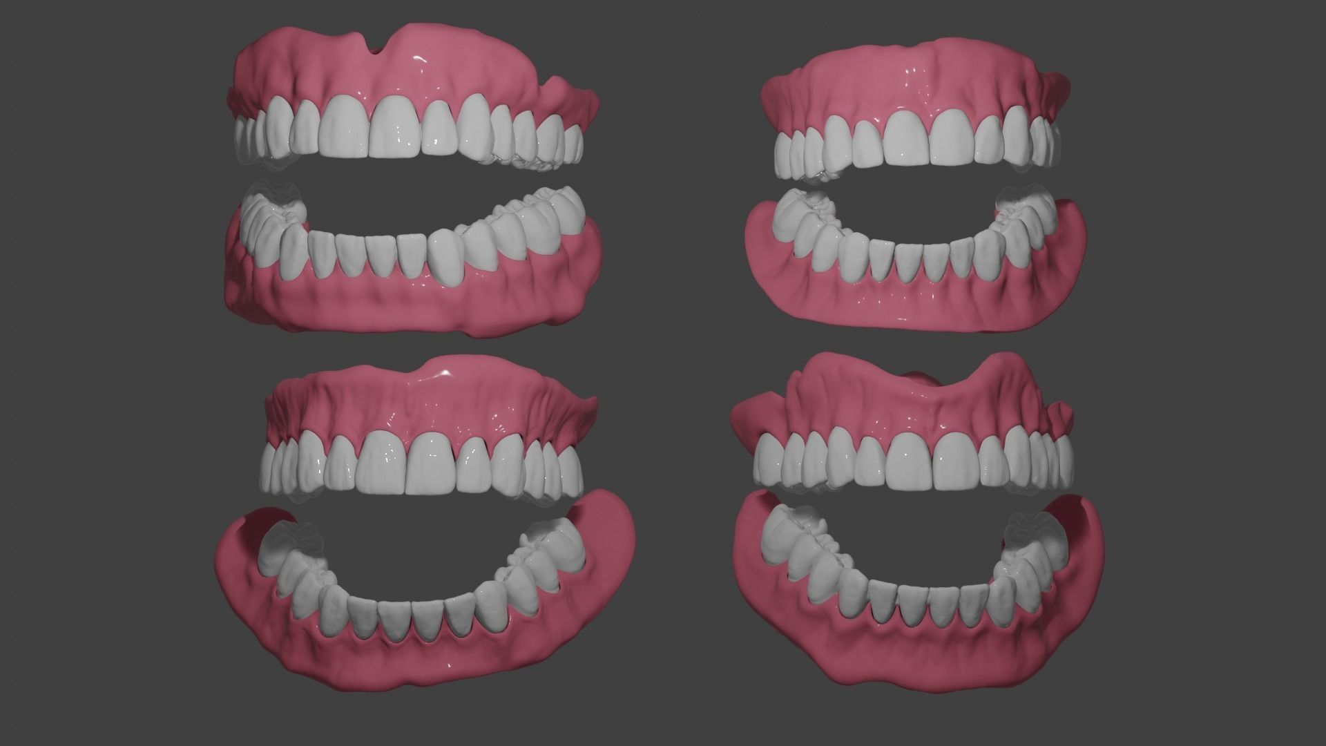 Full denture 3D model_4