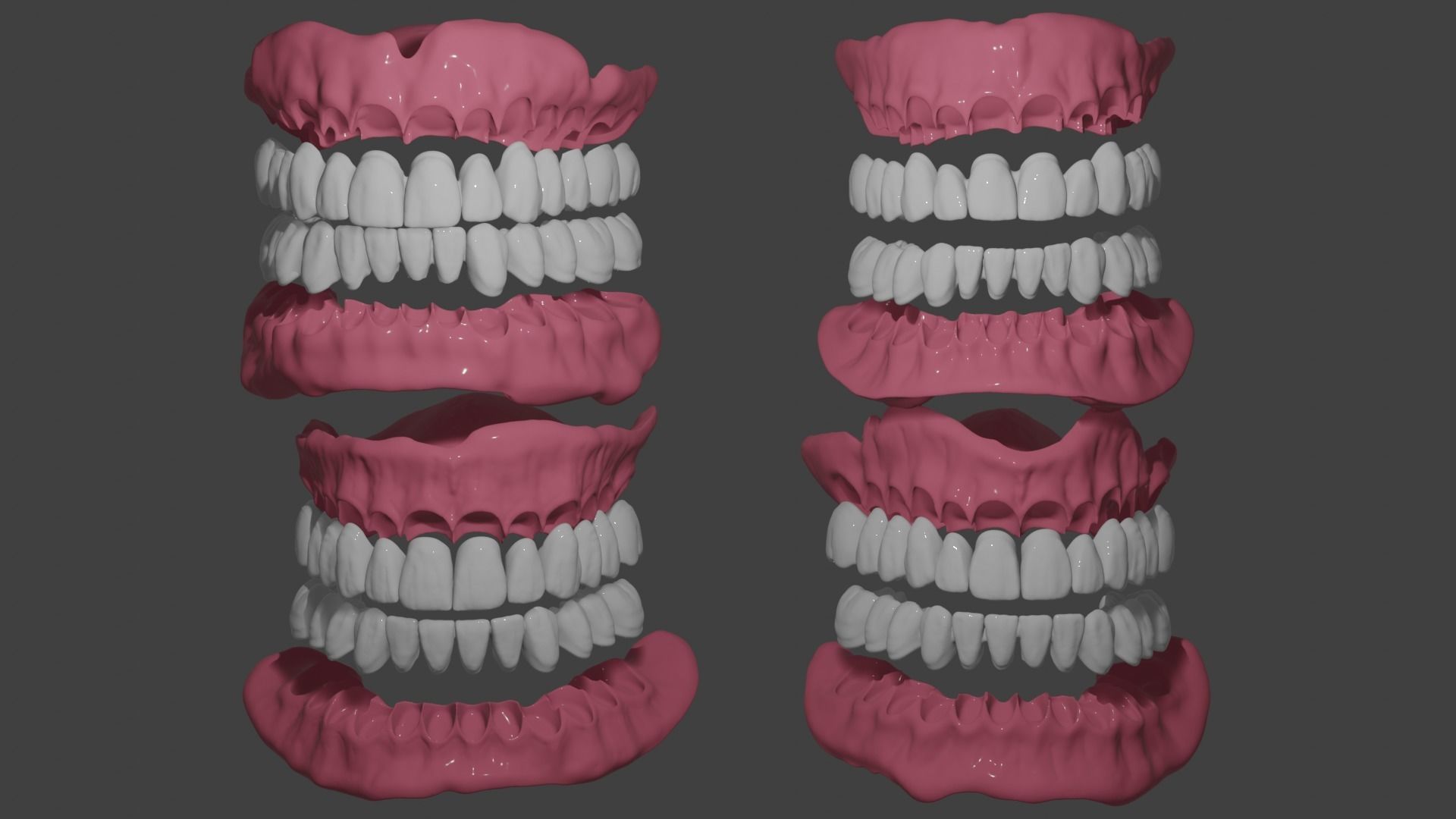 Full denture 3D model_3