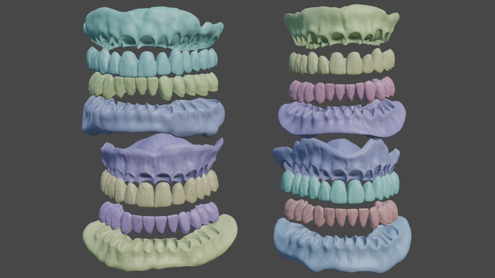 Full denture 3D model_2