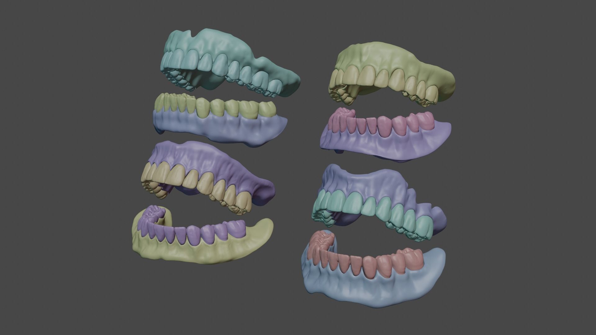 Full denture 3D model_6