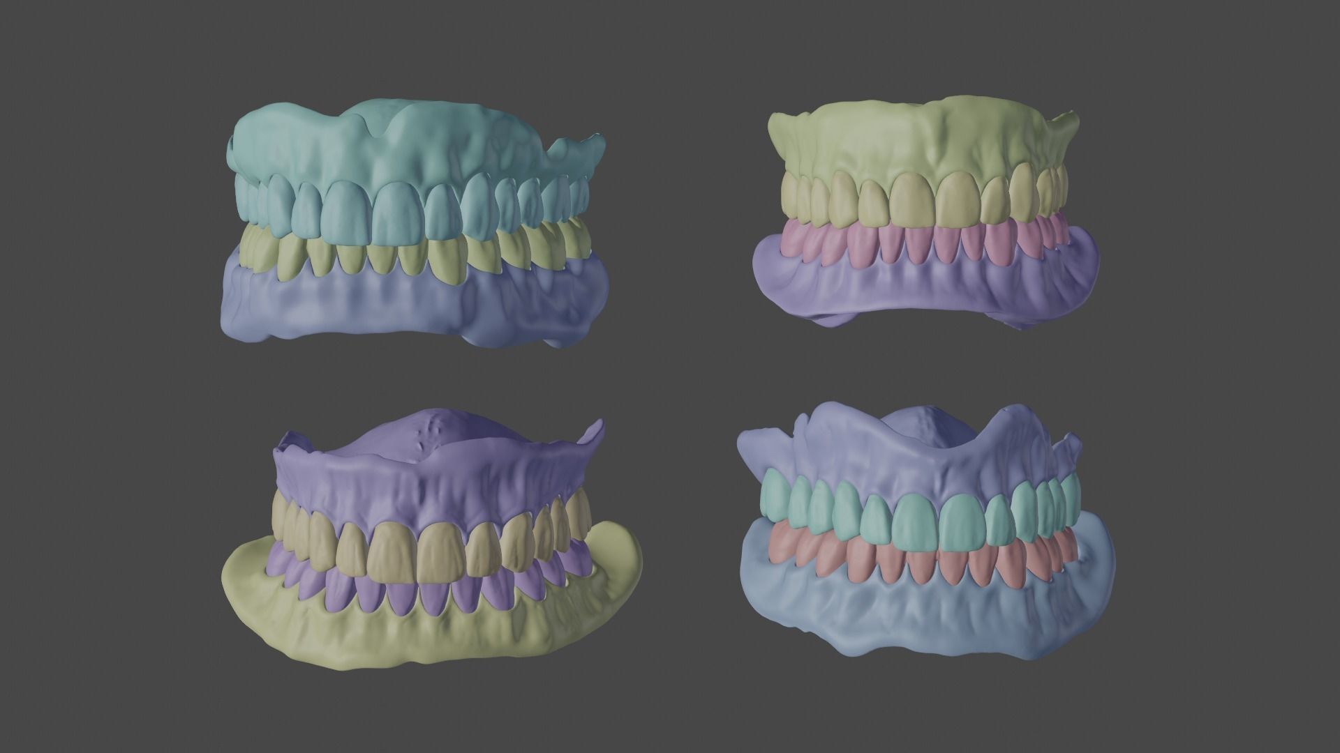 Full denture 3D model_1
