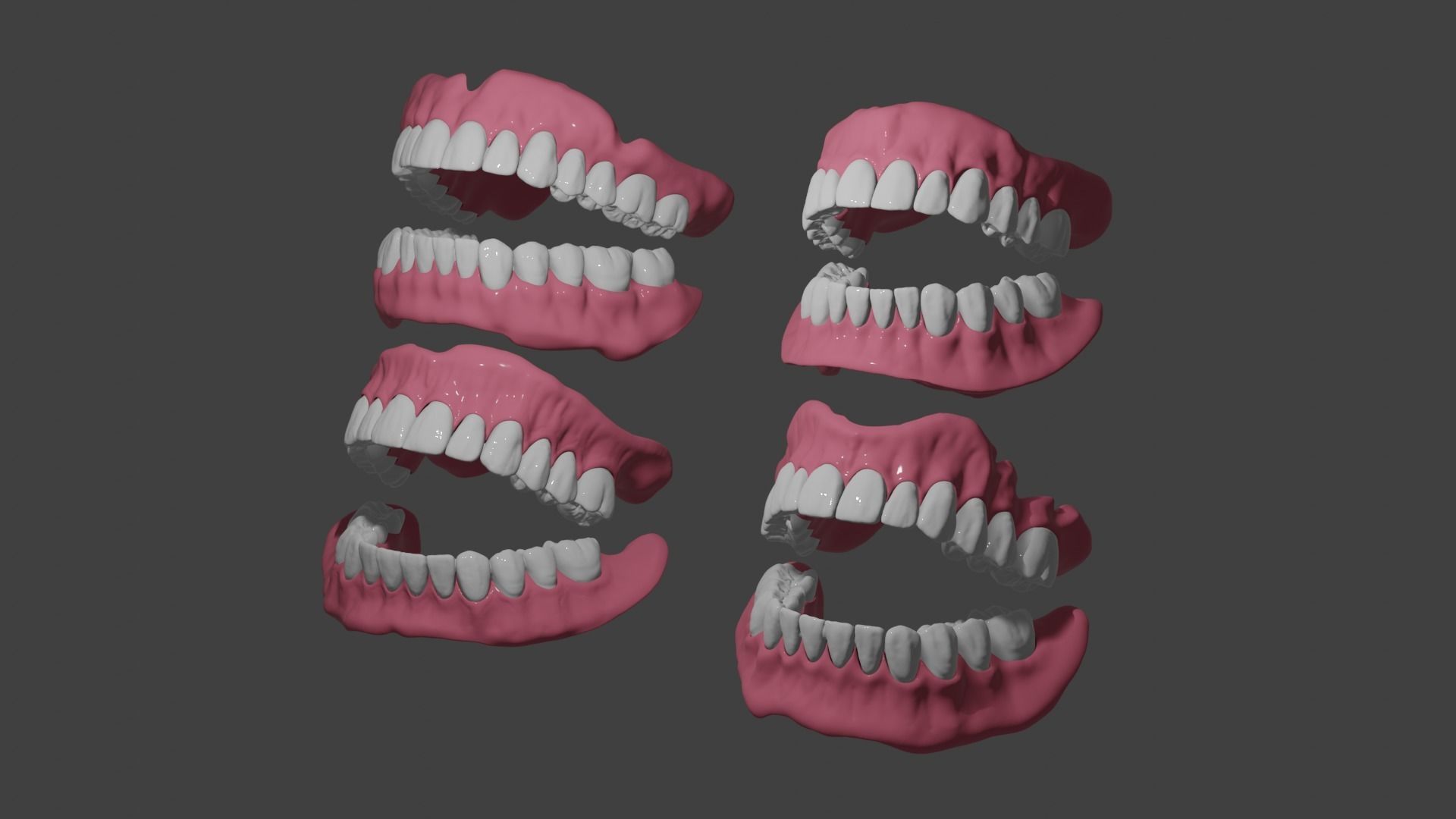 Full denture 3D model_5