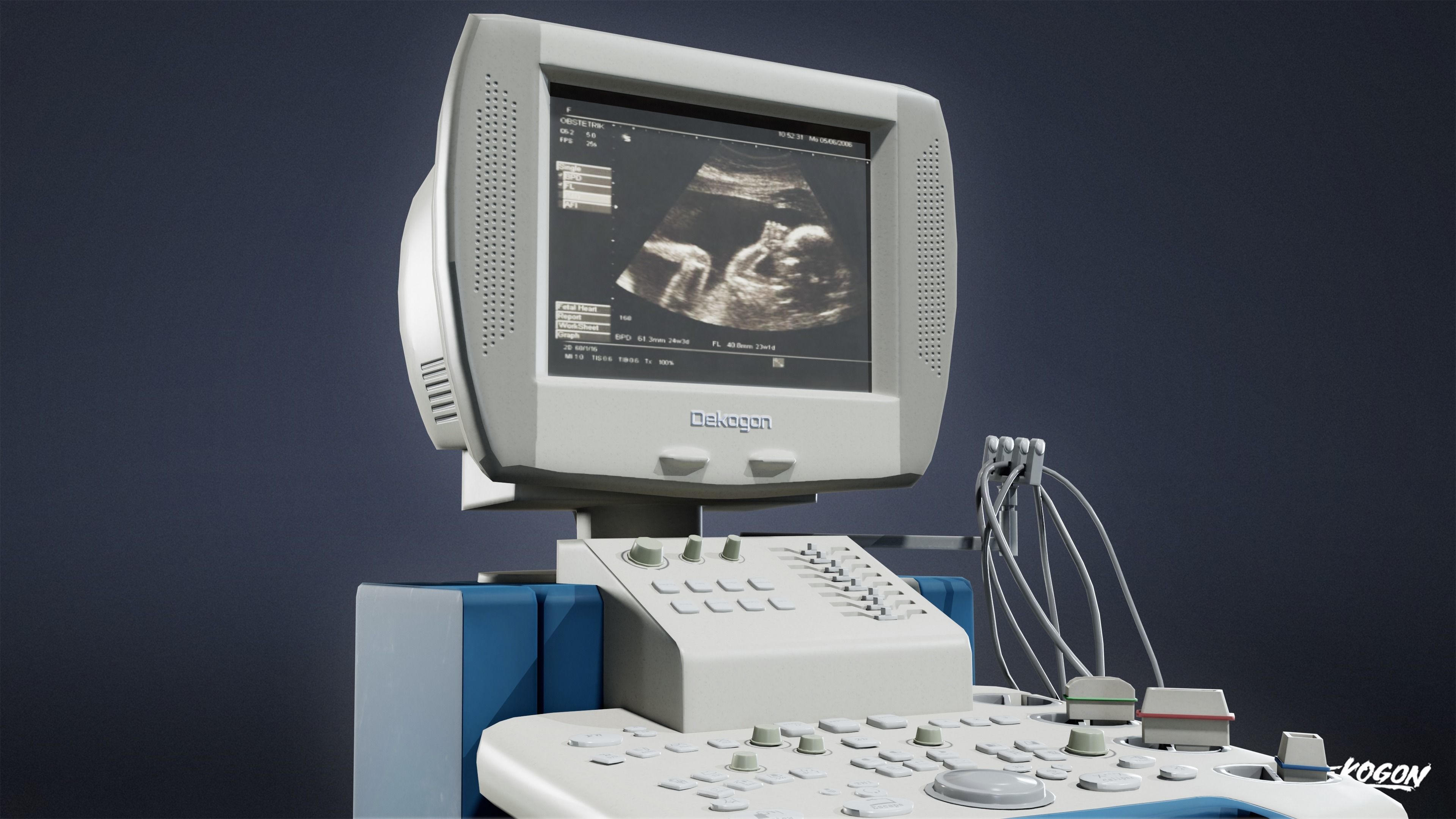 HOSPITAL - Ultrasound Machine 01 - LOW POLY Low-poly 3D model_6