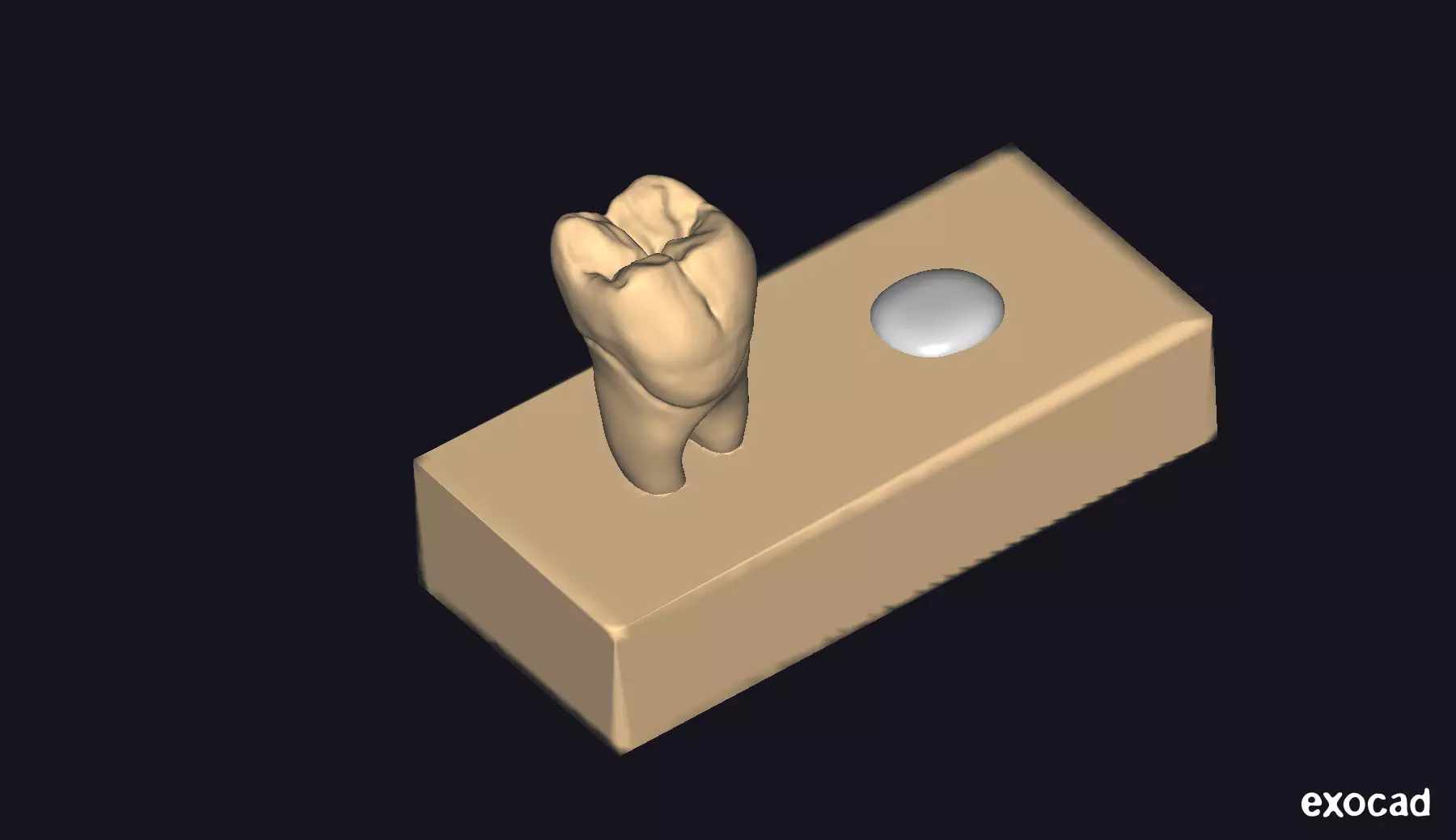 Dental Carving Model of a lower Molar 3D print model