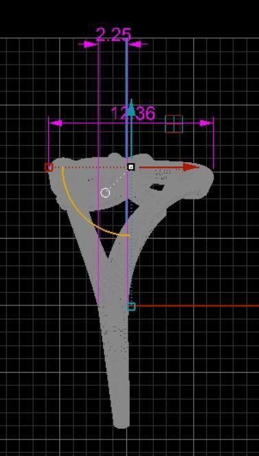 Heart ring 22 3D print model_12