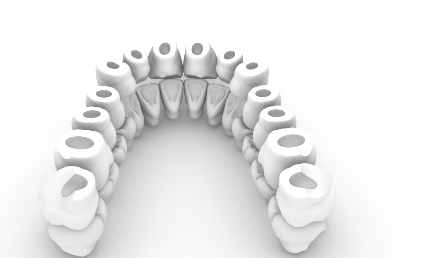 Digital exocad Complete Dentures  3D print model_12