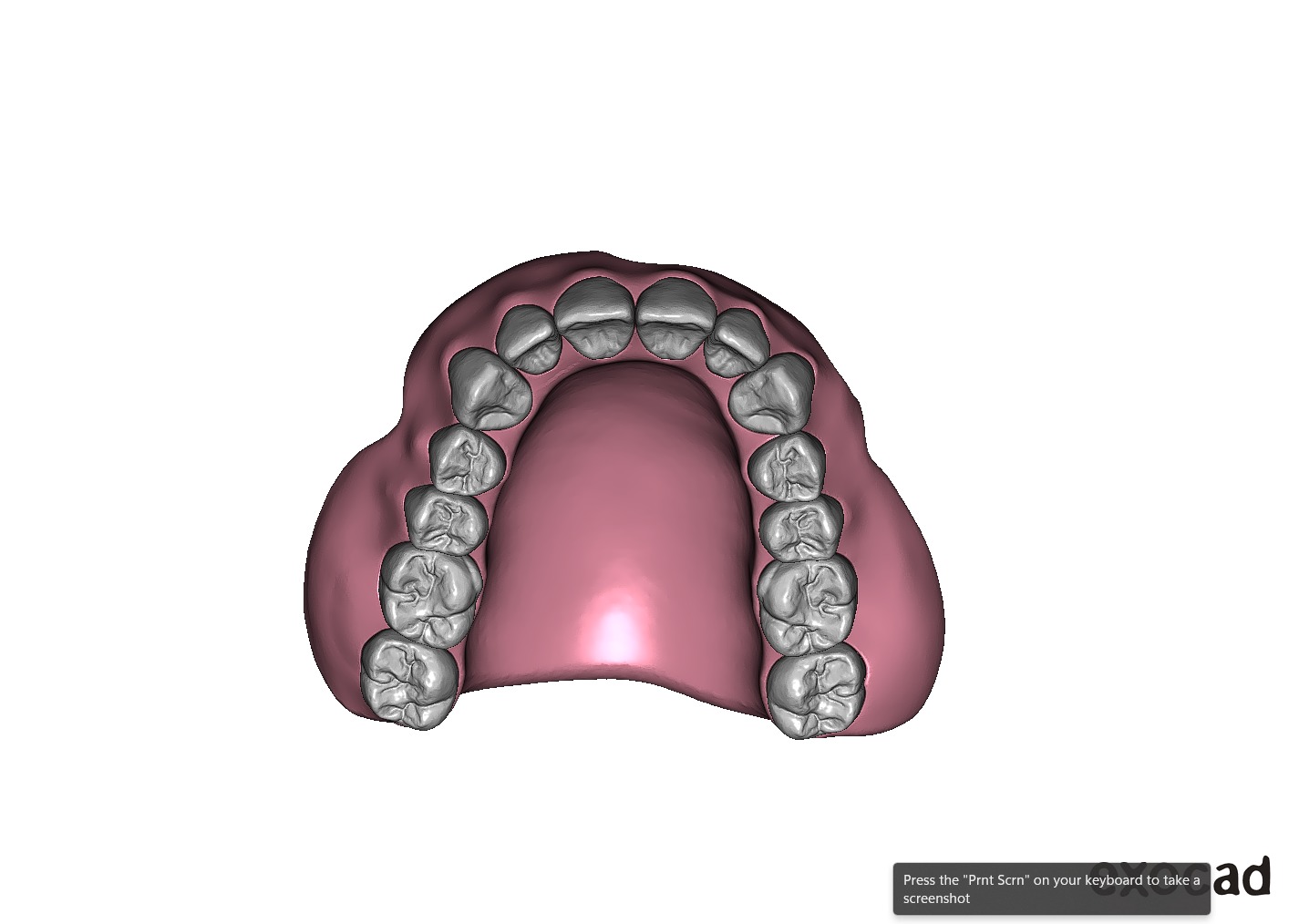 Digital exocad Complete Dentures  3D print model_23