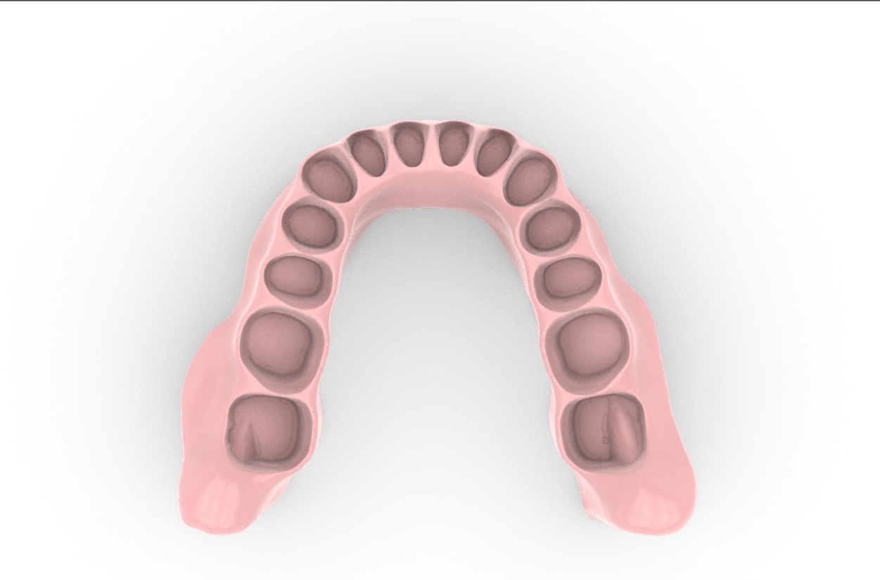 Digital exocad Complete Dentures  3D print model_17