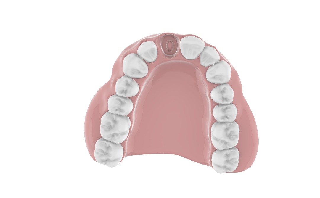 Digital exocad Complete Dentures  3D print model_52