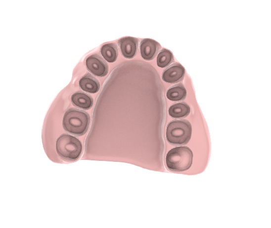 Digital exocad Complete Dentures  3D print model_3