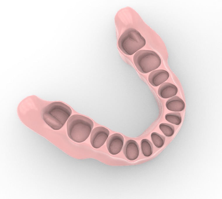 Digital exocad Complete Dentures  3D print model_9