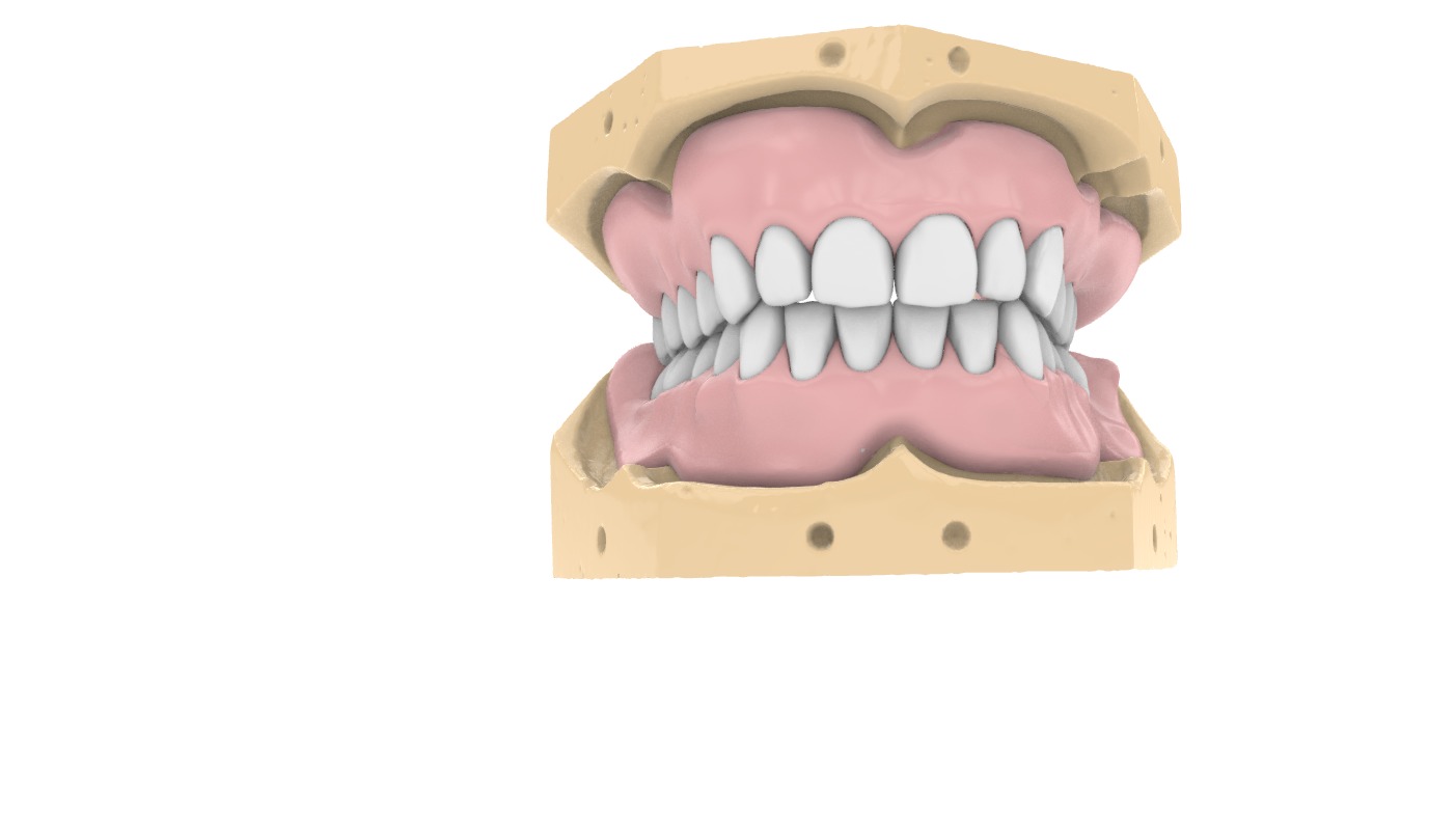 Digital exocad Complete Dentures  3D print model_7